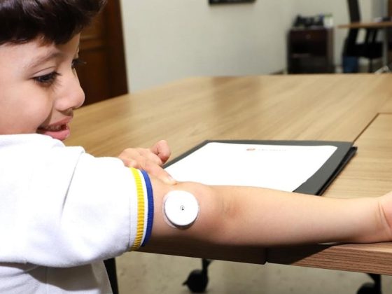 Criança com sensor de glicose para crianças fixado no braço