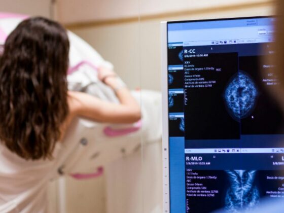 Mulher realizando exame de Minhas Mamografias com imagens do resultado exibidas em monitor ao fundo