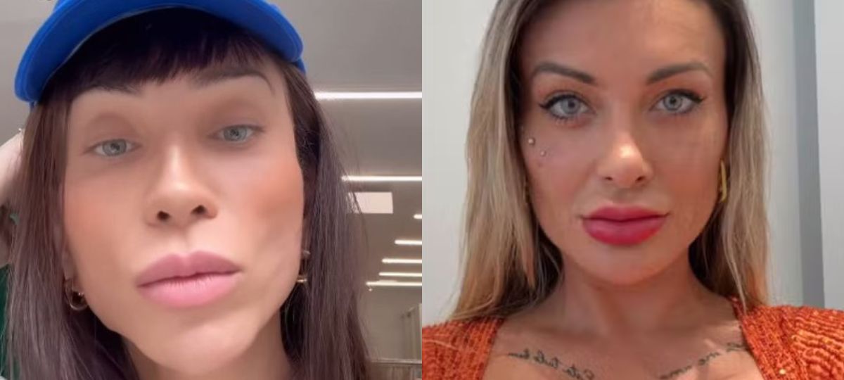 cirurgia cor dos olhos famosos