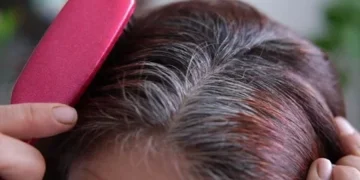 Cabelo branco