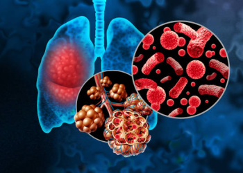 pneumonia