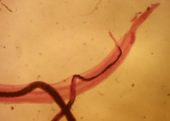 Parasita