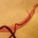 Parasita