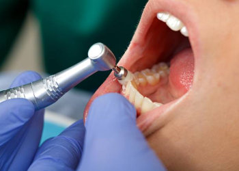 dentes