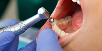 dentes