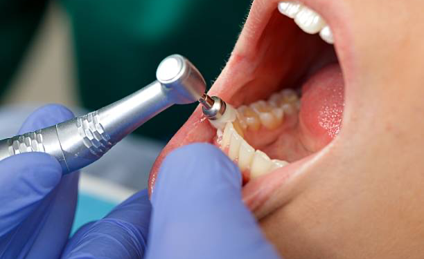 dentes