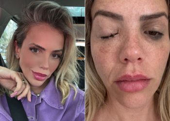 marcelly abreu bacteria olho