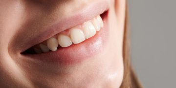 dentes