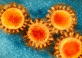 Covid 19 vírus