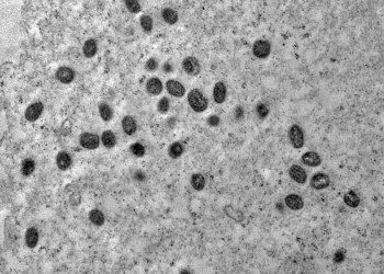 vírus herpes contagioso doença