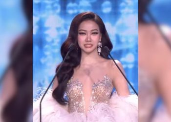 miss concurso dentes caindo