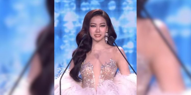 miss concurso dentes caindo