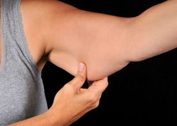 gordura exercicio braço