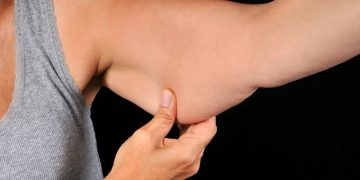 gordura exercicio braço