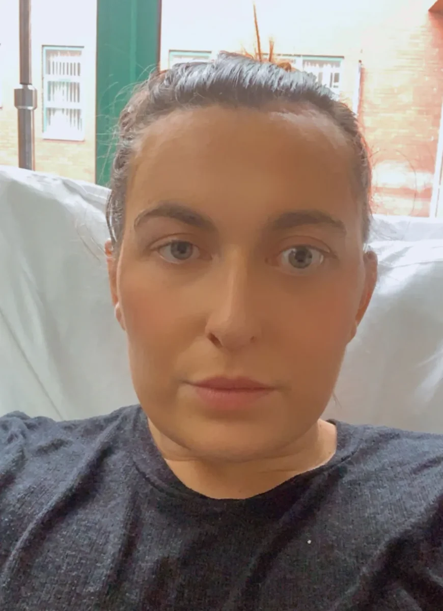 britânica tumor cilios