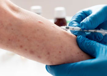 sarampo doença vacina