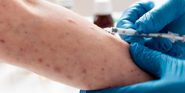 sarampo doença vacina