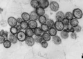 hantavirus virus oms gripe surto