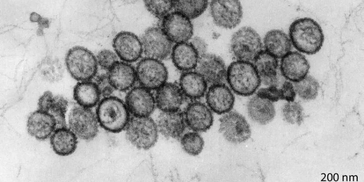 hantavirus virus oms gripe surto