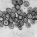 hantavirus virus oms gripe surto