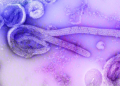 virus ebola