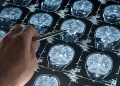 cerebro envelhecimento