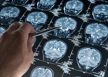 cerebro envelhecimento