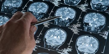 cerebro envelhecimento