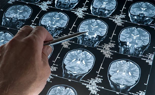 cerebro envelhecimento
