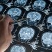 cerebro envelhecimento
