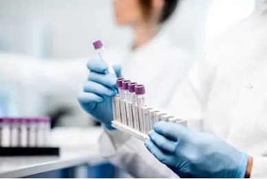 UFMG testa tratamento usado em hipertensos