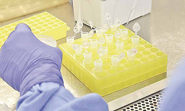 Produção de kits de diagnóstico ganha reforço da Funed