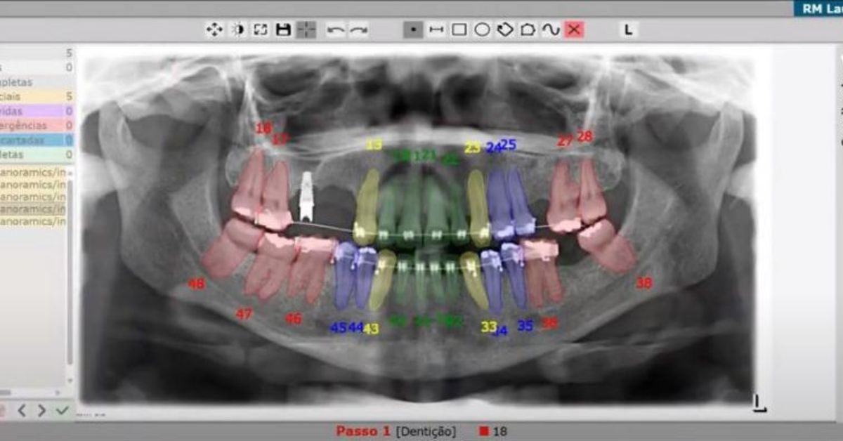 Radiografia odontológica com IA pode ampliar produtividade profissional