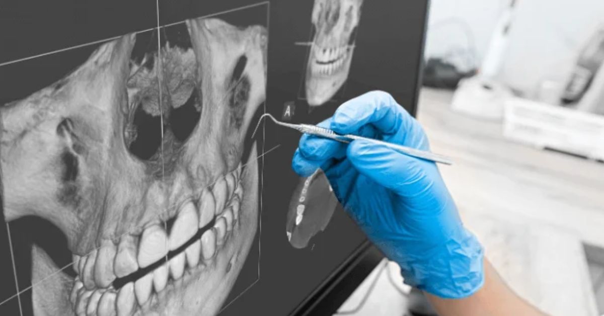No ramo de radiologia, rede de clínicas odontológicas abre 4ª operação em Minas