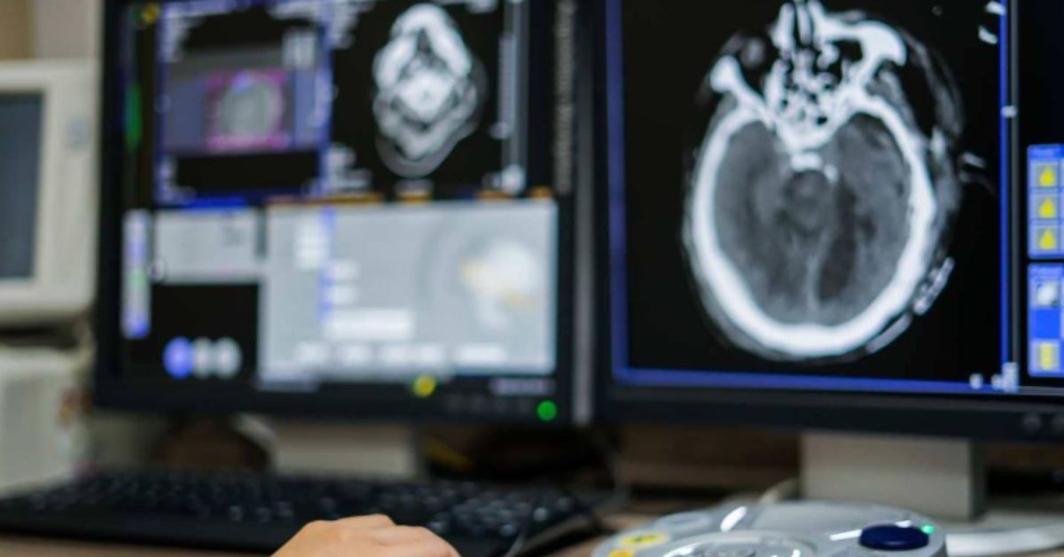 VX Medical Innovation acelera laudos e democratiza radiologia no País