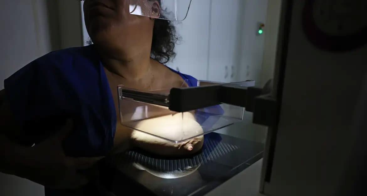 ANS defende que plano cubra mamografia digital sem restrição de idade